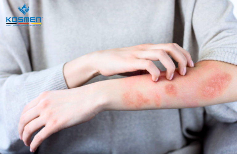 Người bị bệnh ghẻ lở thường có cảm giác ngứa ngáy khó chịu và bệnh này có thể chữa khỏi hoàn toàn