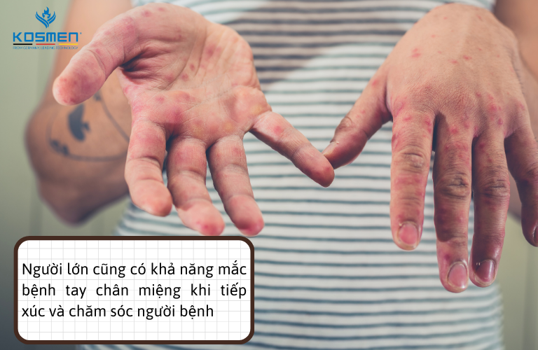 Khi chăm sóc người bệnh, người lớn nên chú ý phòng bệnh để không bị lây bệnh ngược trở lại