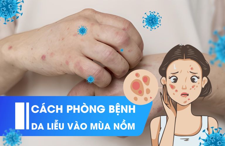 Bệnh Da Liễu Tăng Cao Khi Trời Nồm: Cách Phòng Ngừa